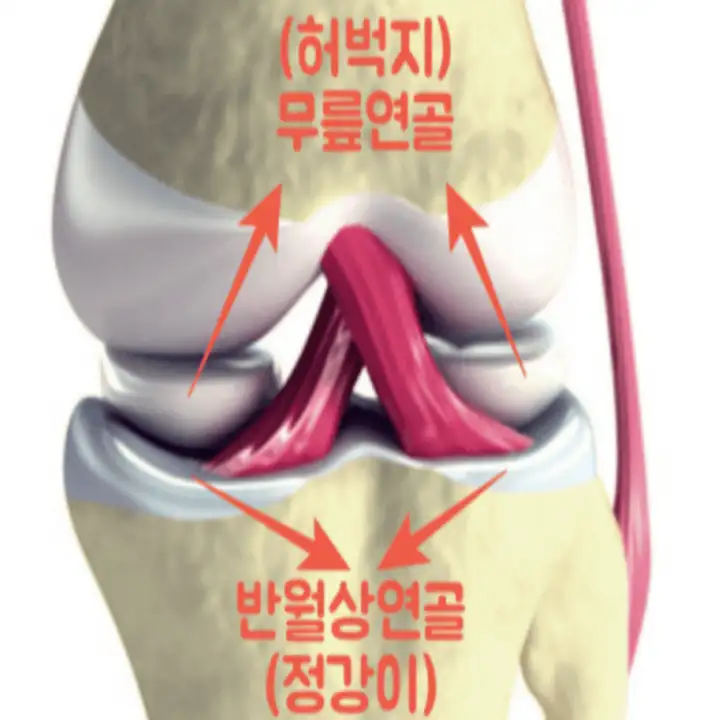 반월상-연골의-위치