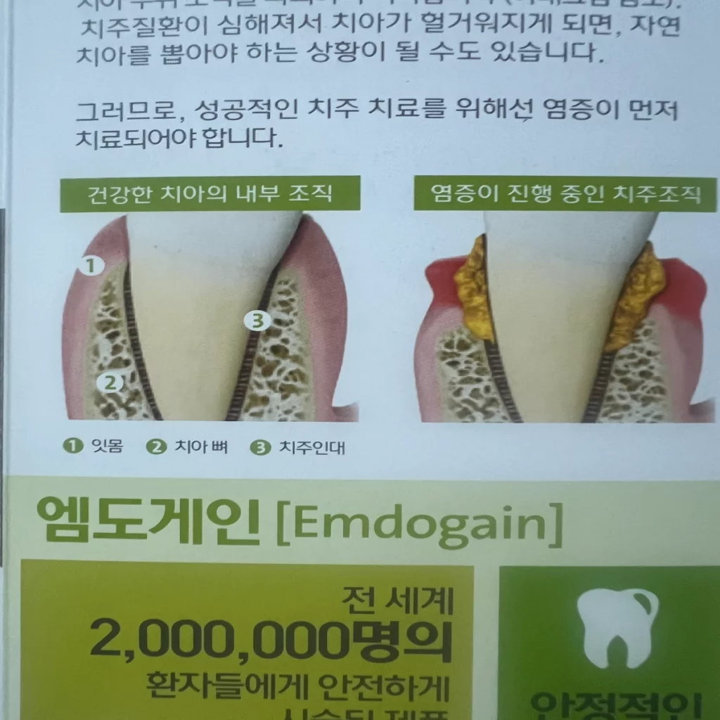 엠도게인-비용-효과-성분을-설명하는-책자의-치주염-사진