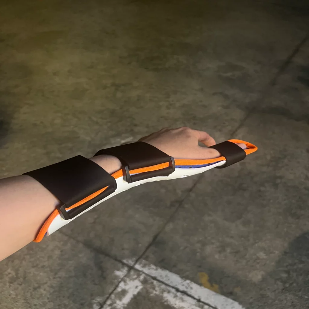 부목을-착용하고-있는-내-모습