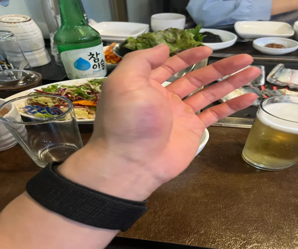 저녁에-보니-엄지손가락-두번째마디-손바닥쪽이-파랗게-멍든-모습