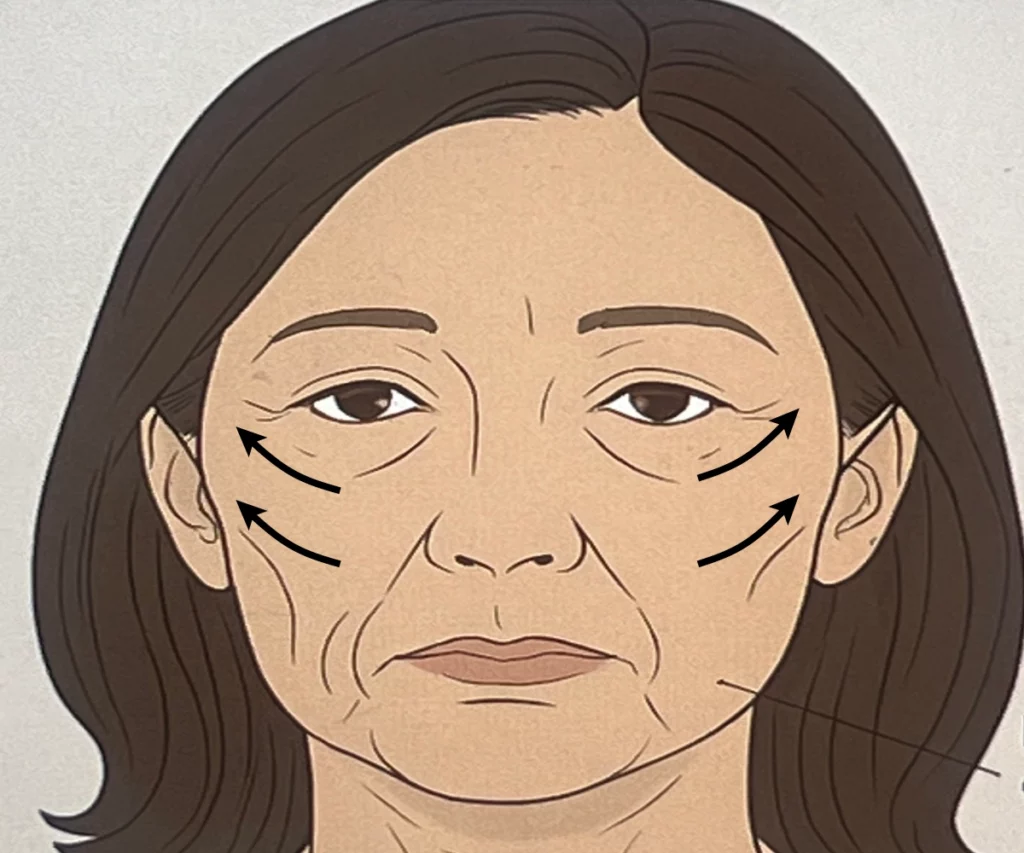 비절개-안면거상술-가격-상담-때-찍은-얼굴-모습