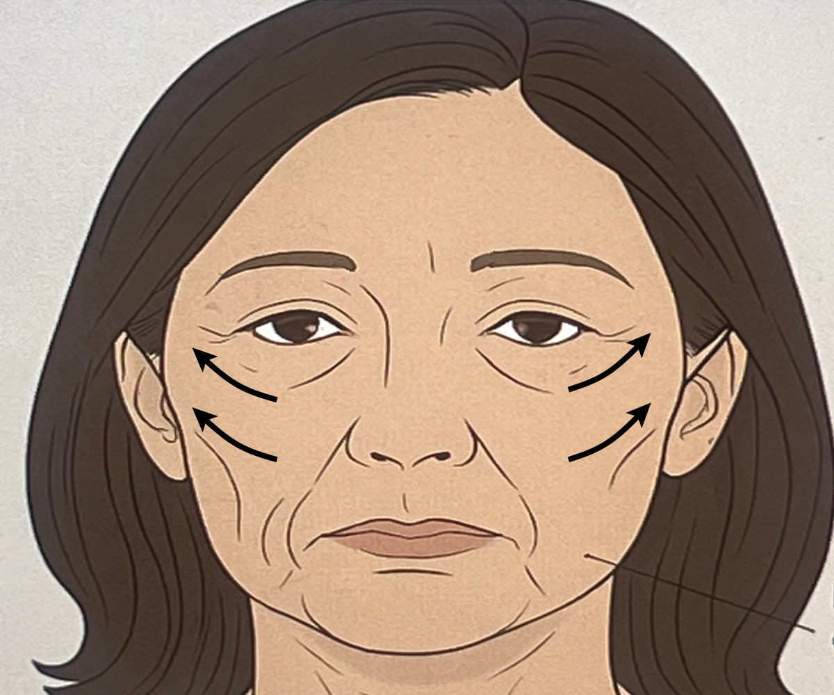 비절개-안면거상술-가격-상담-때-찍은-얼굴-모습