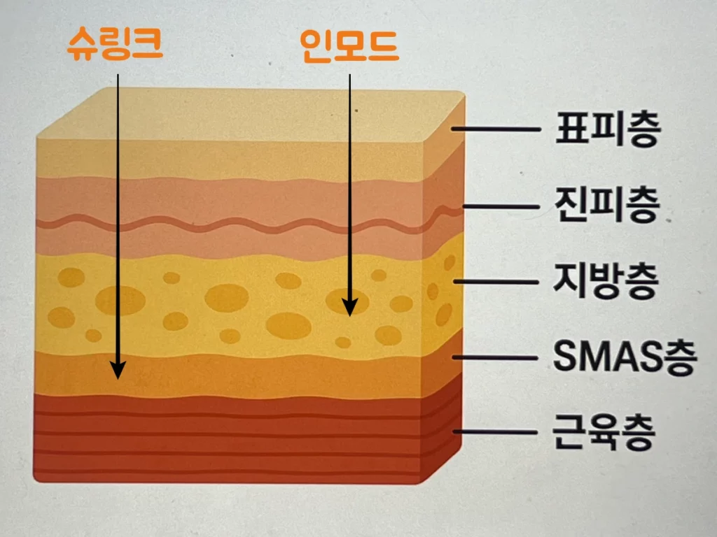 슈링크-인모드-차이-열이-도달하는-피부층