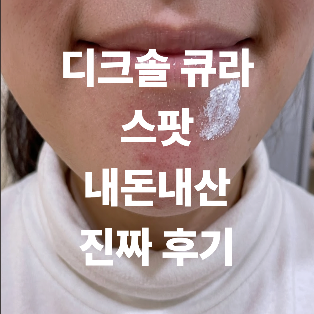 디크솔 큐라스팟 내돈내산 효과 후기를 증명하기 위해 찍은 셀카 사진