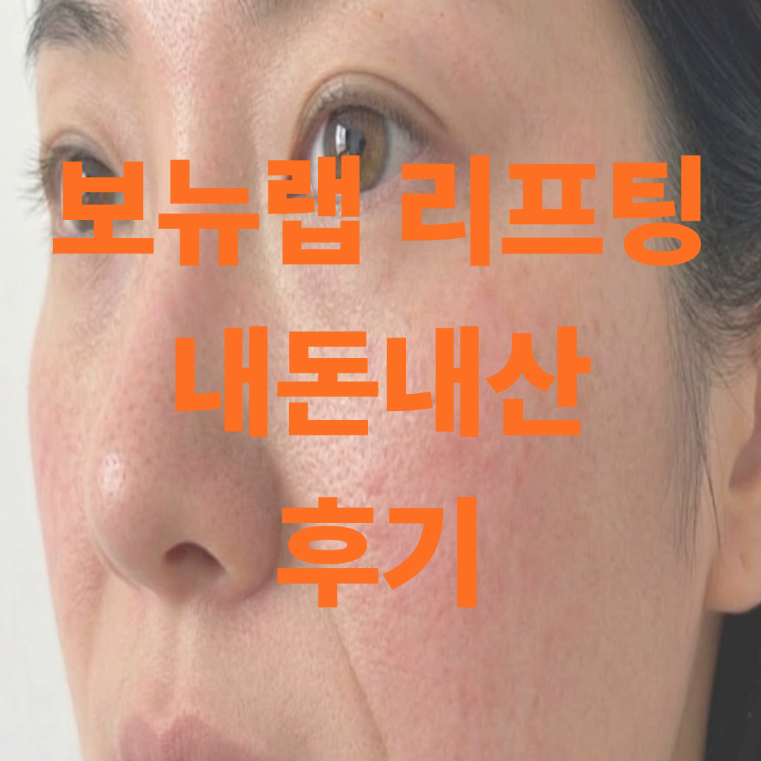 보뉴랩 리프팅 크림 효과 후기를 작성하기 위해 찍은 내 얼굴 셀카