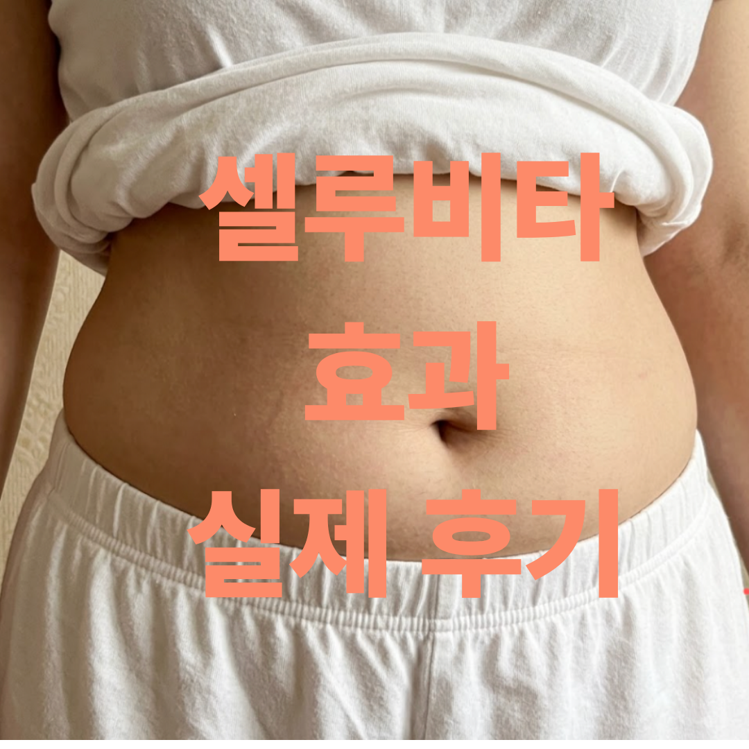 셀루비타 효과 후기 인증하기 위해 찍은 뱃살 셀카 사진