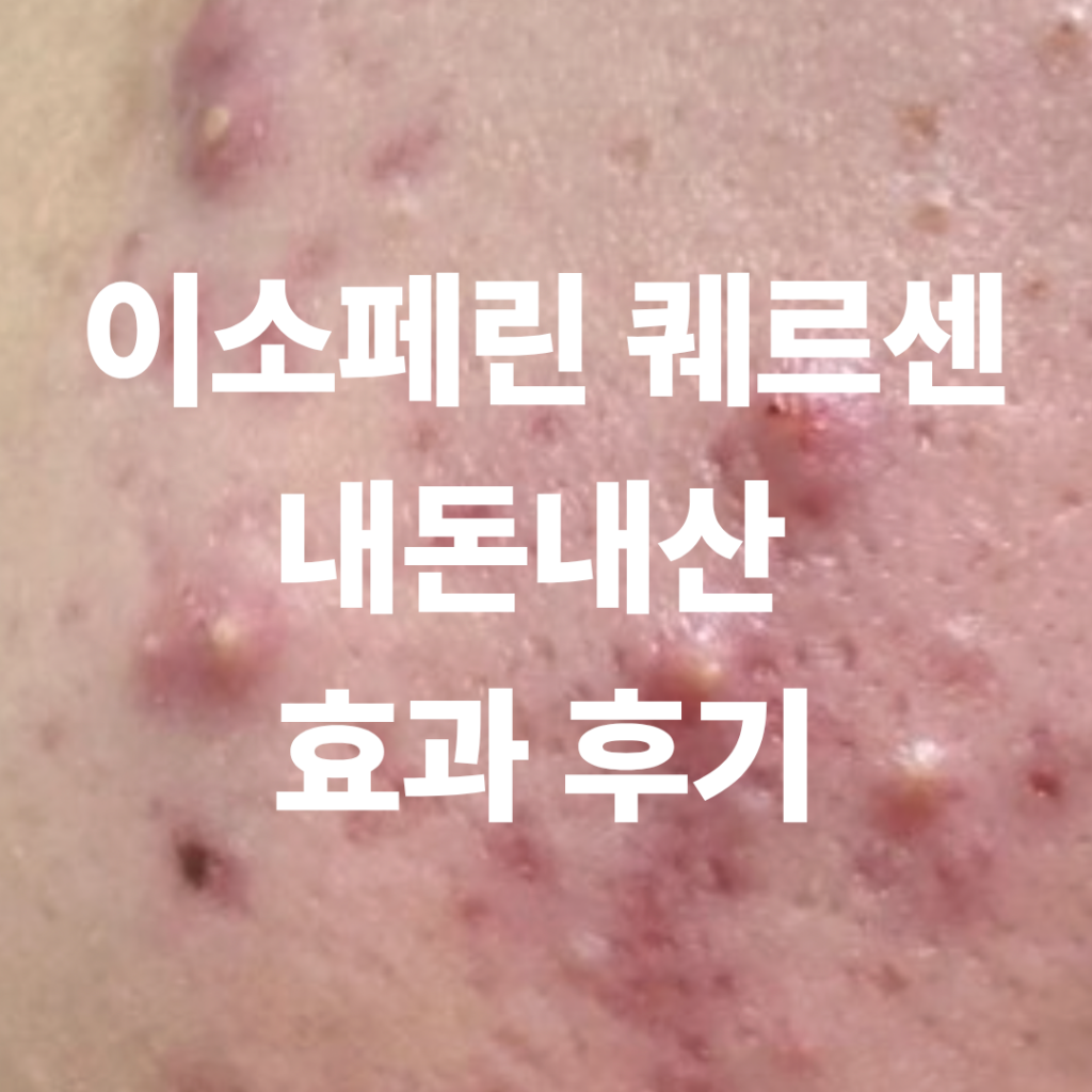 이소페린 퀘르센 후기 증명하기 위한 여드름 셀카 사진