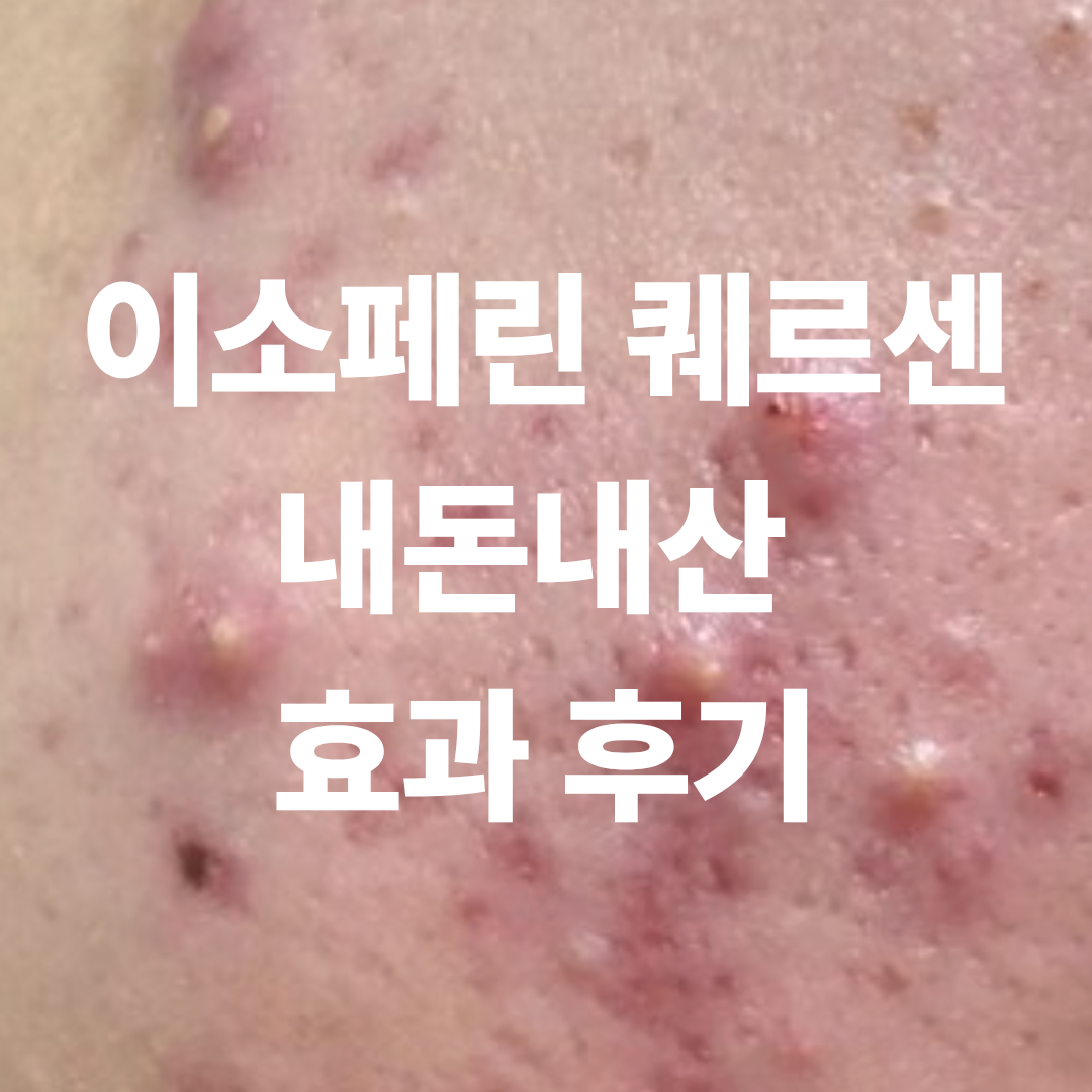 이소페린 퀘르센 효과 보기 전 후기 작성을 위해 찍어 둔 여드름 셀카 사진